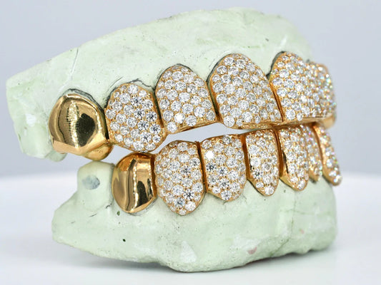 8 On 8 Capped VVS Moissanite Grillz