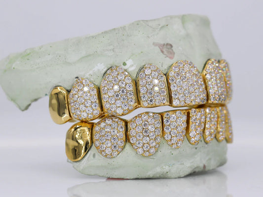 10 On 10 Capped VVS Moissanite Grillz