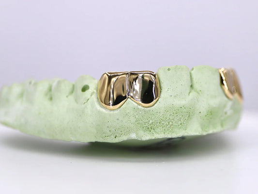 2 Solid Gold Teeth Grillz