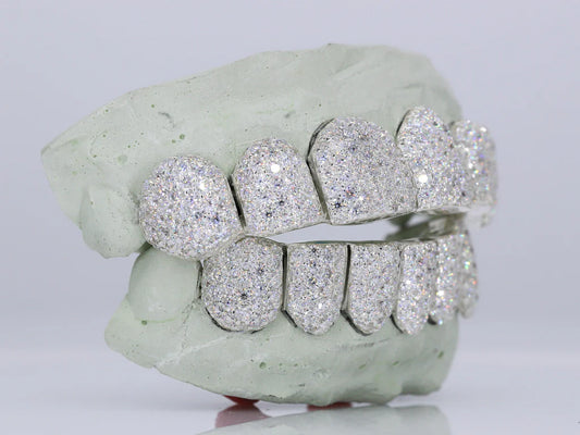 6 On 6 VVS Moissanite Grillz