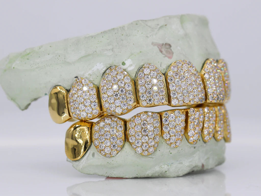 10 On 10 Capped VVS Moissanite Grillz