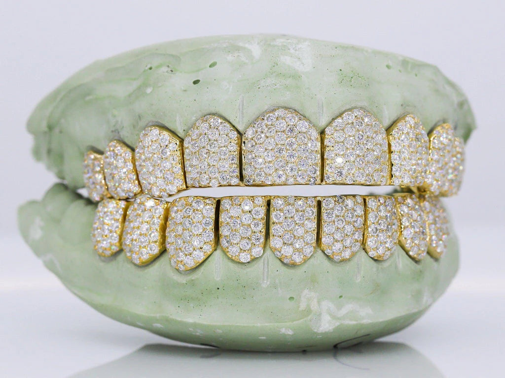 10 On 10 VVS Moissanite Grillz