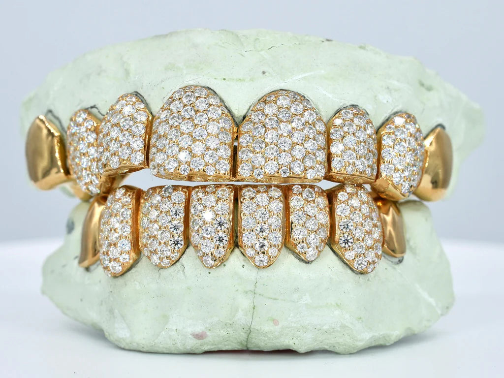8 On 8 Capped VVS Moissanite Grillz