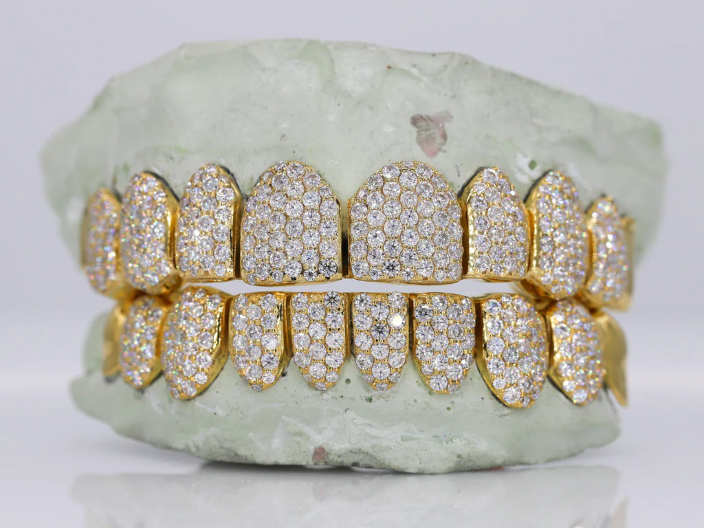 10 On 10 Capped VVS Moissanite Grillz