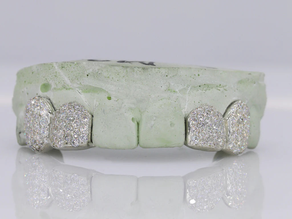 2 VVS Moissanite Teeth Grillz