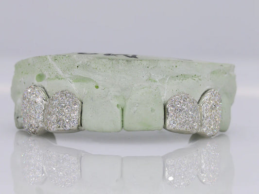 2 VVS Moissanite Teeth Grillz