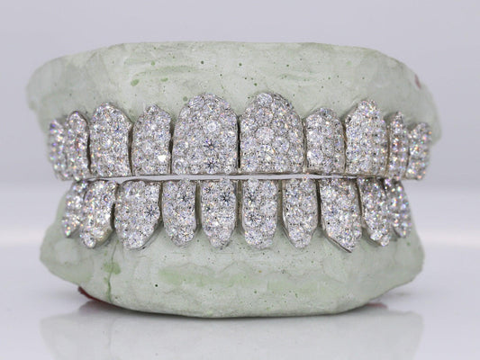 Jumbo VVS Moissanite Grillz - Silver