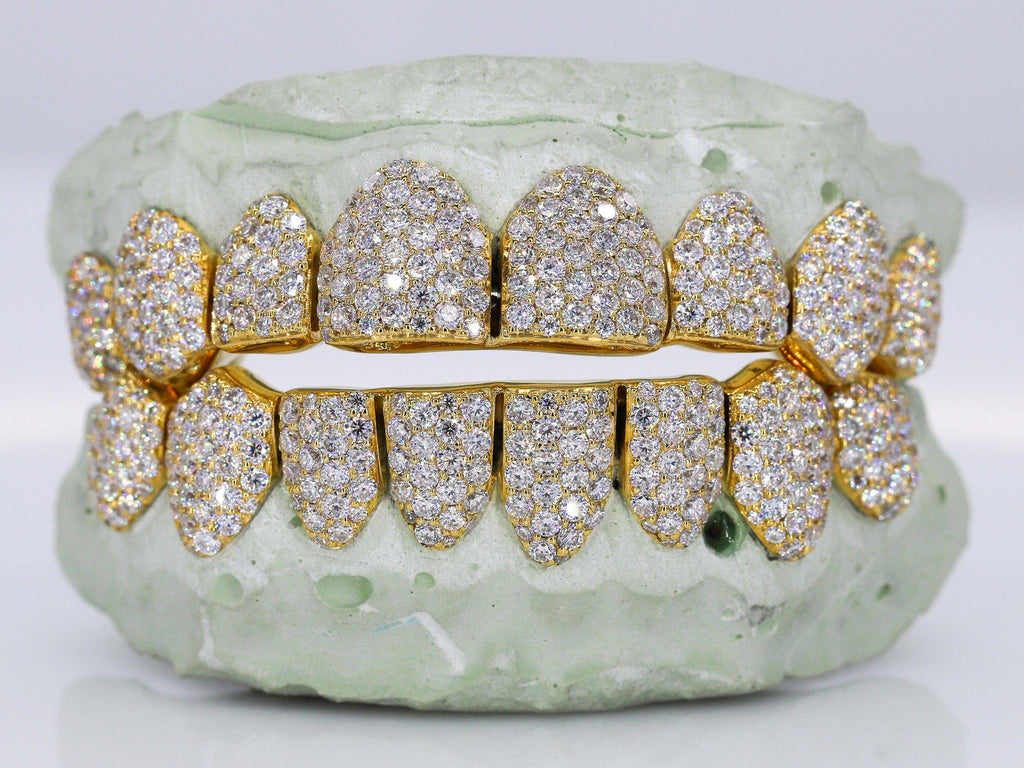 8 On 8 VVS Moissanite Grillz