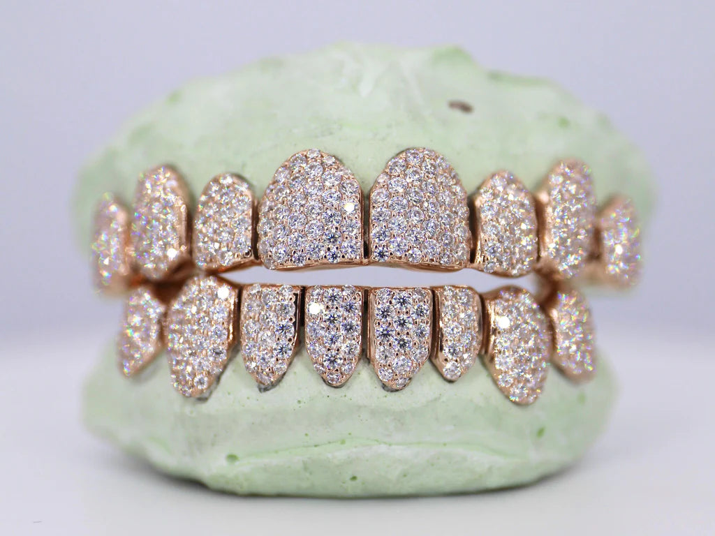 8 On 8 VVS Moissanite Grillz