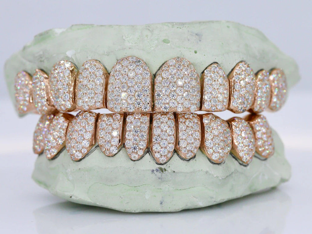 10 On 10 VVS Moissanite Grillz