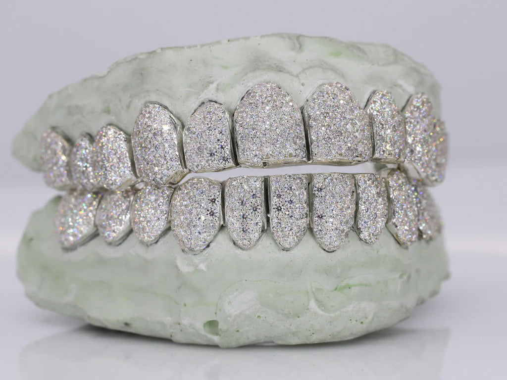 12 On 12 VVS Moissanite Grillz