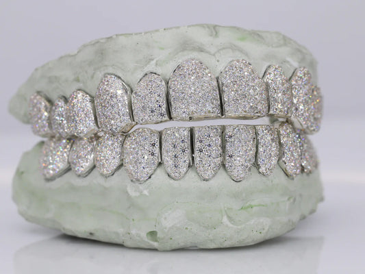 12 On 12 VVS Moissanite Grillz