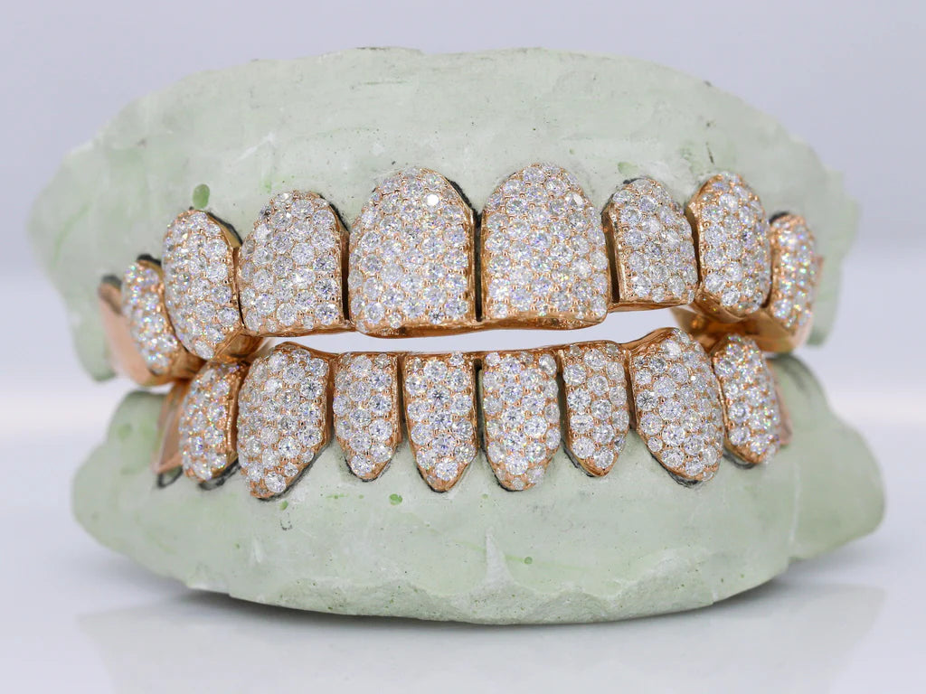 10 On 10 Capped VVS Moissanite Grillz