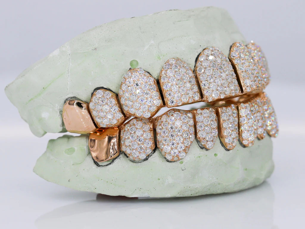 10 On 10 Capped VVS Moissanite Grillz