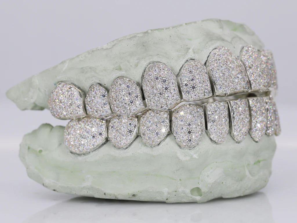 12 On 12 VVS Moissanite Grillz