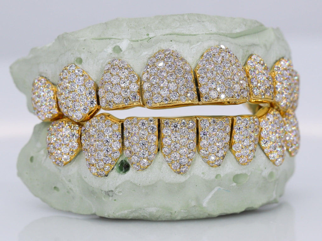 8 On 8 VVS Moissanite Grillz
