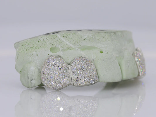 2 VVS Moissanite Teeth Grillz