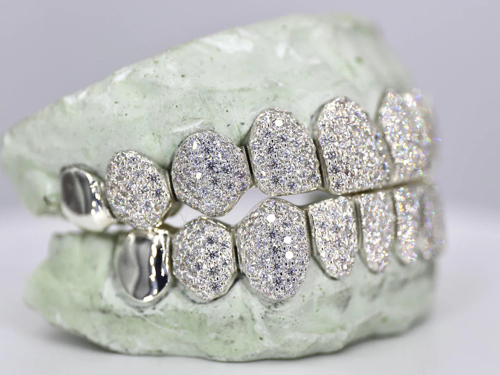 10 On 10 Capped VVS Moissanite Grillz