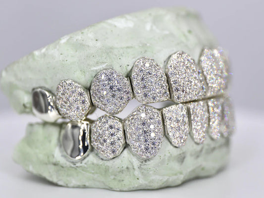 10 On 10 Capped VVS Moissanite Grillz