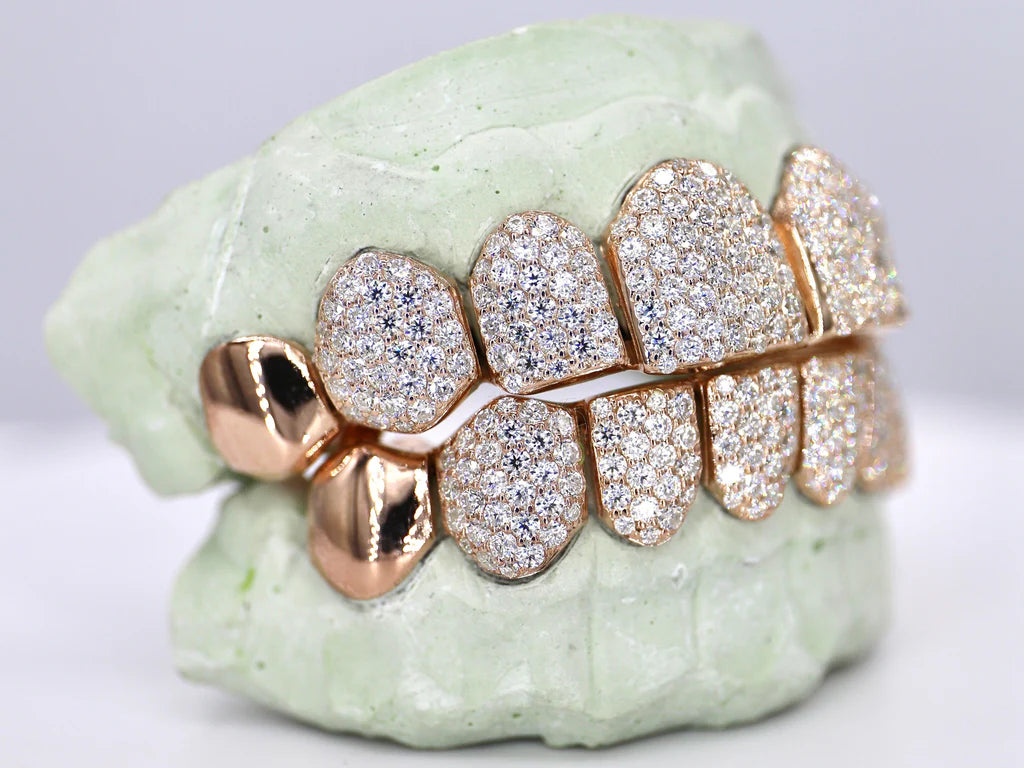 8 On 8 Capped VVS Moissanite Grillz