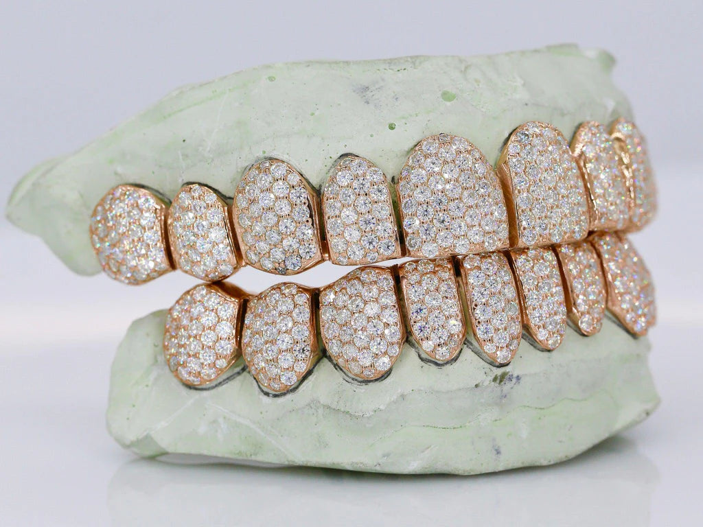 10 On 10 VVS Moissanite Grillz