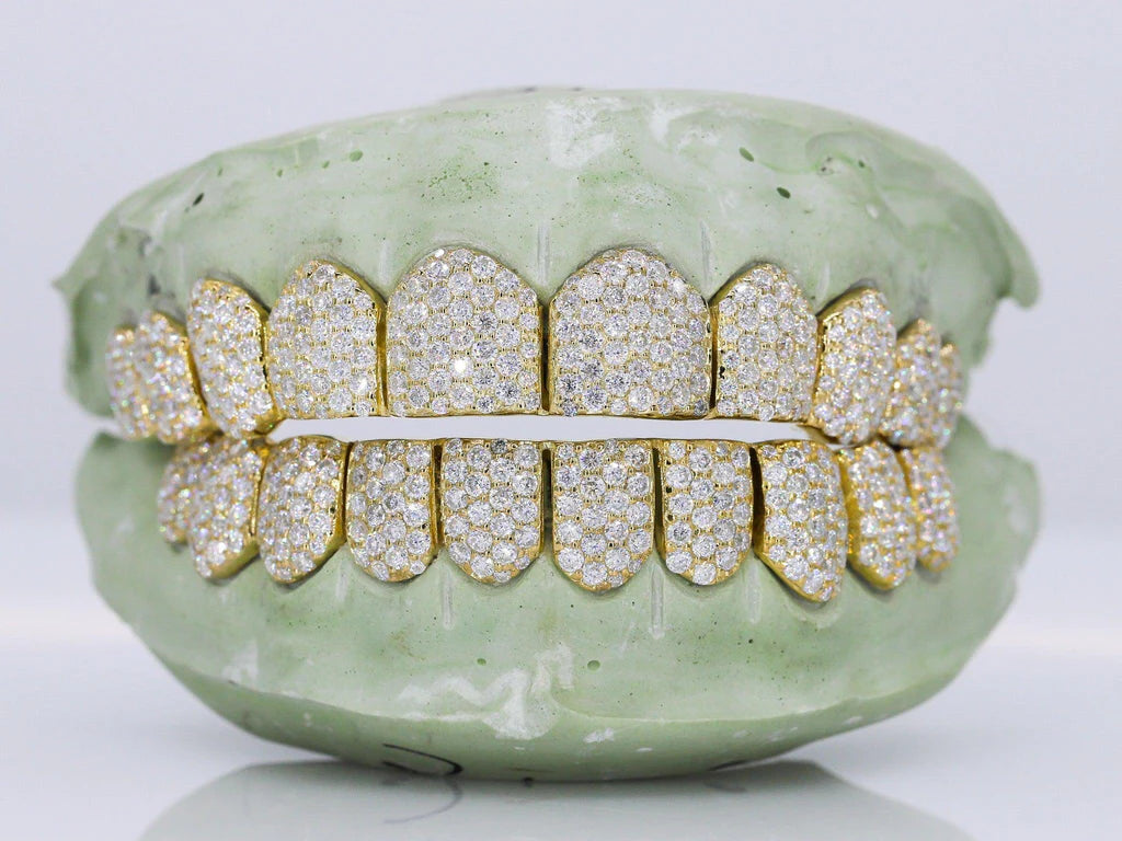 10 On 10 VVS Moissanite Grillz