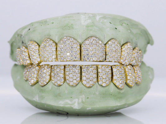 10 On 10 VVS Moissanite Grillz