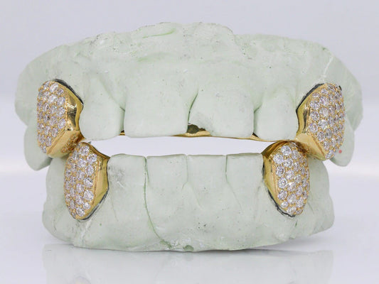VVS Moissanite Grillz - Fangs