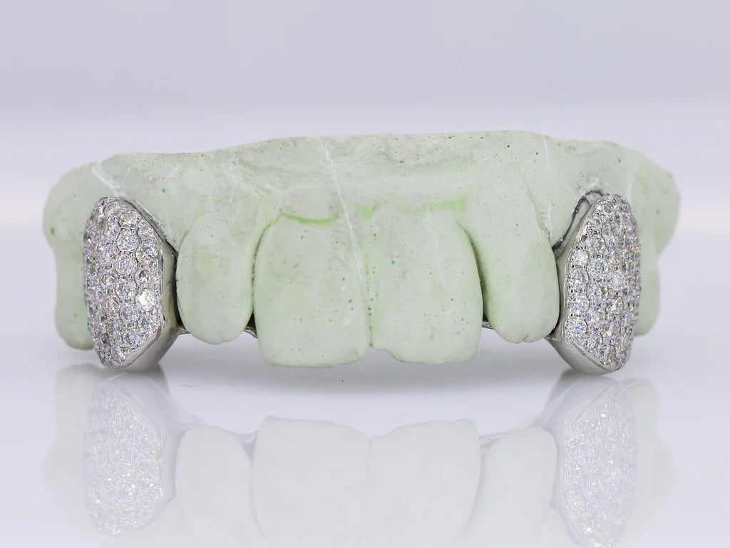 VVS Moissanite Grillz - Fangs