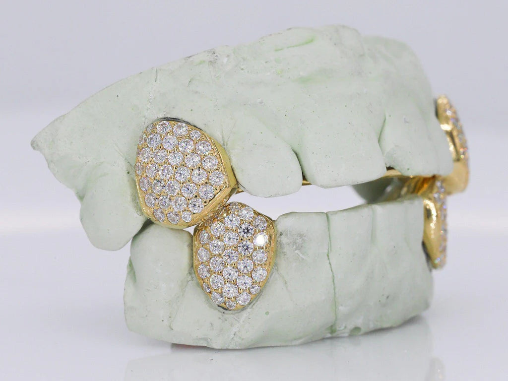VVS Moissanite Grillz - Fangs