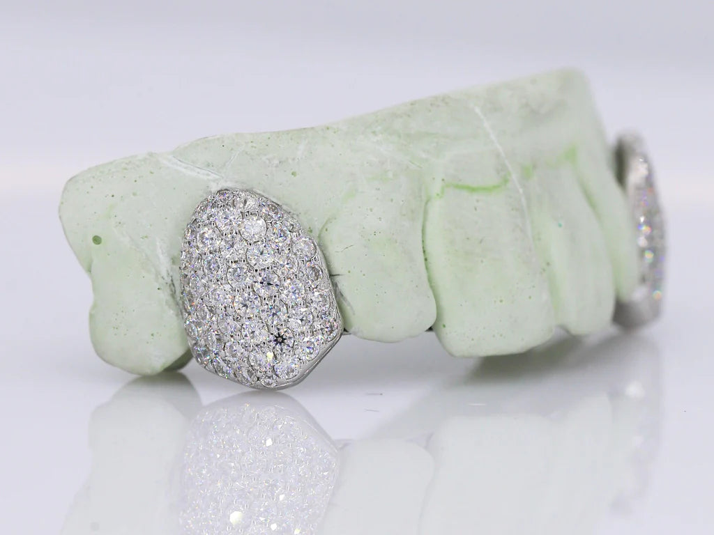 VVS Moissanite Grillz - Fangs